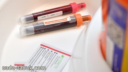 اختبار جديد للدم يُبشر بالكشف المبكر عن "اللوكيميا"‎‎