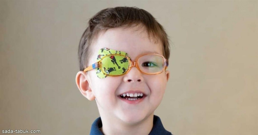 "خالد للعيون" يوضح أسباب مرض كسل العين الوظيفي الشائع لدى الأطفال وطرق علاجه