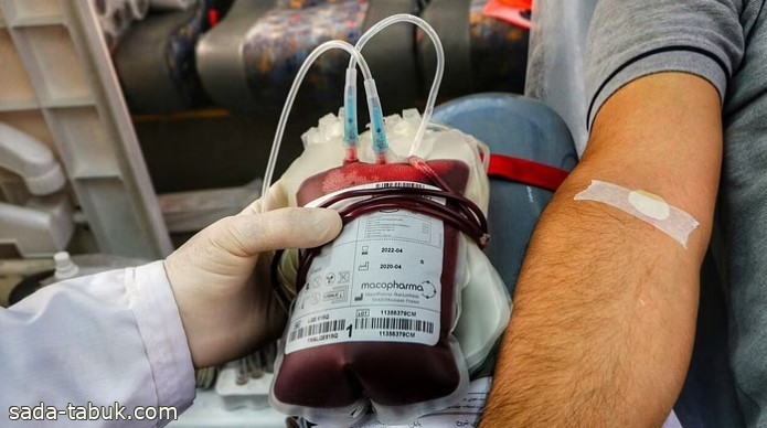 «الصحة»: يمكن التبرع بالدم بعد مرور 3 أشهر من الحجامة