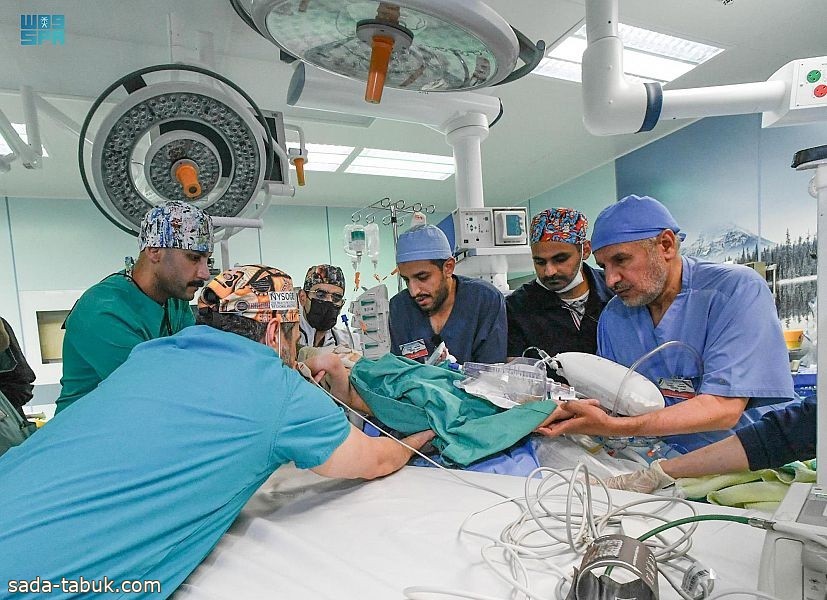 نجاح فصل التوأم السيامي السوري إحسان وبسام بعد عملية جراحية دقيقة استغرقت 7 ساعات ونصف