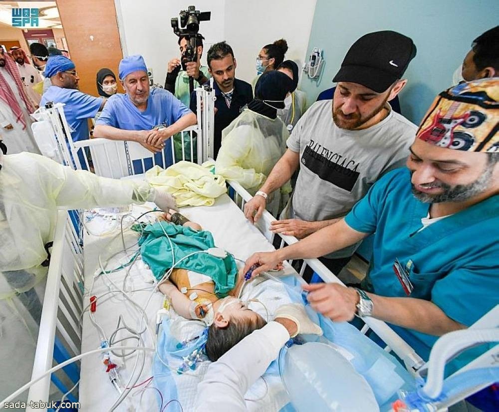 استقرار الحالة الصحية للتوأم السيامي السوري «بسام» ورفع أجهزة التنفس الاصطناعي عنه