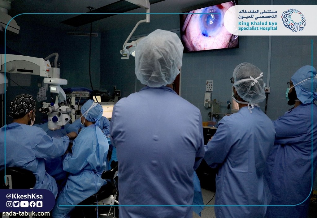 مستشفى "التخصصي للعيون " يجري عملية "اندو إن" لزراعة البطانة الداخلية