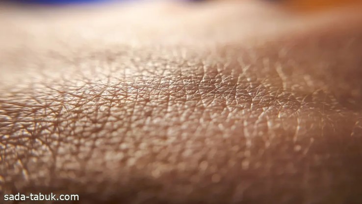 لأول مرة.. اكتشاف هيموغلوبين في الطبقة العليا من جلد الإنسان