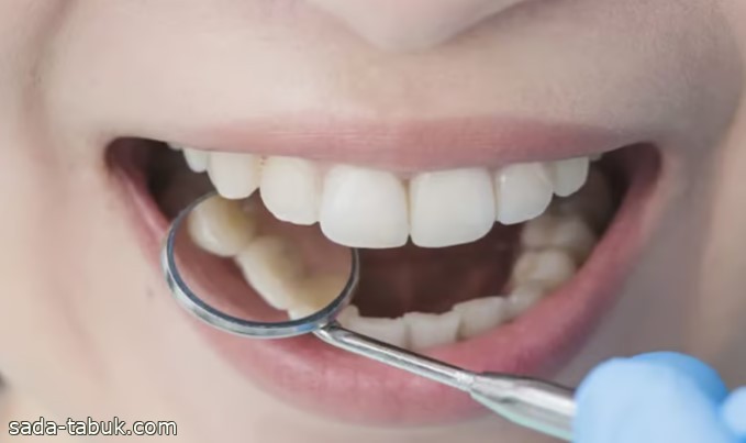 أحدها يوجِب مراجعة الطبيب فورًا.. أخصائية روسية تكشف أبرز 4 أنواع لألم الأسنان