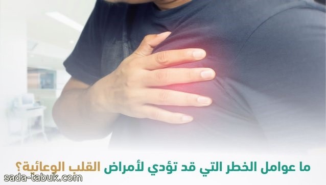 منها التدخين.. 7 عوامل قد تؤدي لأمراض القلب الوعائية تبرزها "سعود الطبية"