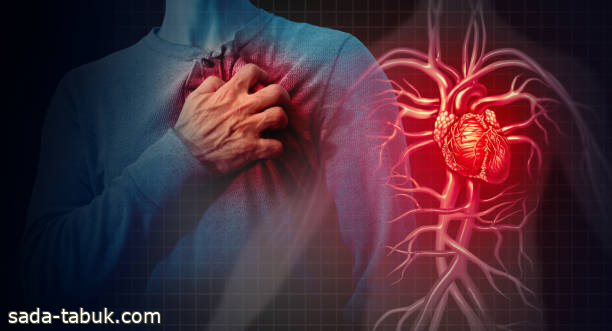 دراسة: أعراض النوبات القلبية لدى المرأة تختلف عن الرجل
