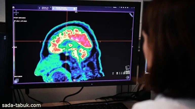 دراسة تكشف حقيقة تأثير "متلازمة هافانا" على المخ